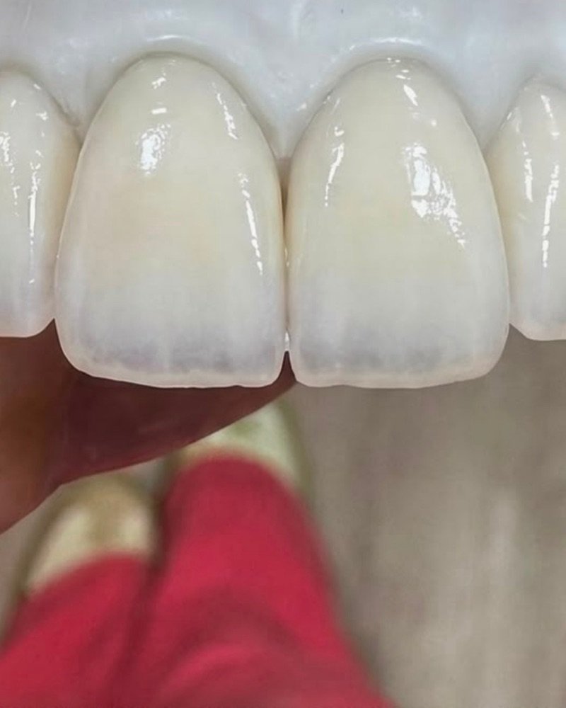 Lentes de resina com acabamento natural e brilho